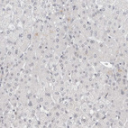 Anti-RECQL4 Antibody