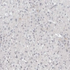 Immunohistochemical staining of human liver shows no positivity in hepatocytes as expected.