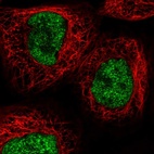 Anti-RECQL4 Antibody