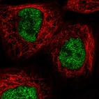Immunofluorescent staining of human cell line A-431 shows localization to nucleoplasm.