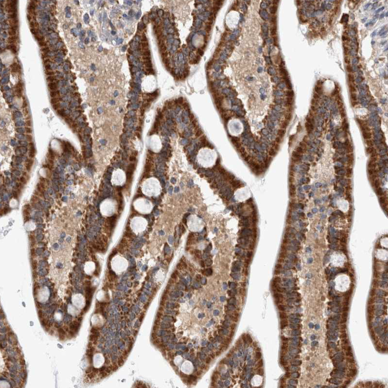 Anti-MRPL37 Antibody