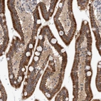 Anti-MRPL37 Antibody