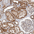 Immunohistochemical staining of human kidney shows strong granular cytoplasmic positivity in cells in tubules.