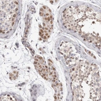 Immunohistochemical staining of human testis shows moderate granular cytoplasmic positivity in Leydig cells.