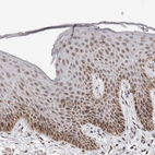 Immunohistochemical staining of human skin shows moderate granular cytoplasmic positivity in squamous epithelial cells.