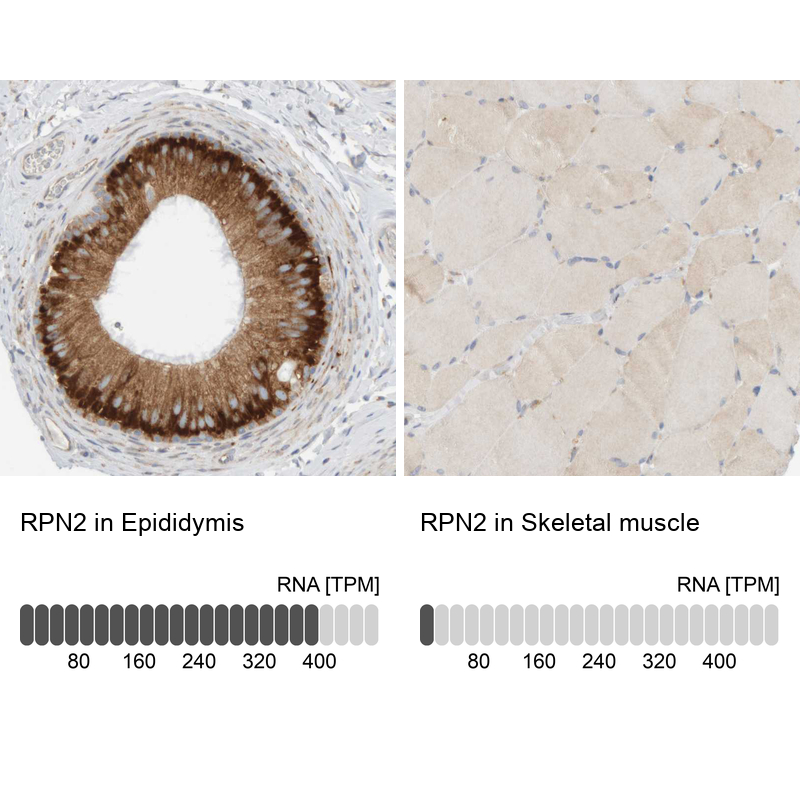 Anti-RPN2 Antibody