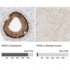 Anti-RPN2 Antibody