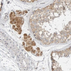 Immunohistochemical staining of human testis shows moderate granular cytoplasmic positivity in Leydig cells.
