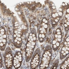 Immunohistochemical staining of human colon shows moderate granular cytoplasmic positivity in glandular cells.