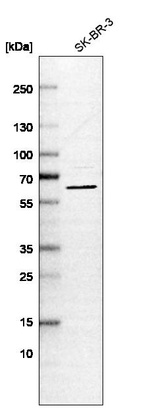 Western blot analysis in human cell line SK-BR-3.