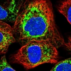 Immunofluorescent staining of human cell line A-431 shows localization to endoplasmic reticulum.
