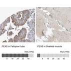 Anti-PEX6 Antibody