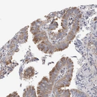 Immunohistochemical staining of human fallopian tube shows moderate to strong cytoplasmic positivity in glandular cells.