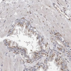 Immunohistochemical staining of human prostate shows moderate cytoplasmic positivity in glandular cells.