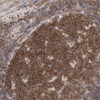 Immunohistochemical staining of human tonsil shows moderate to strong cytoplasmic positivity in germinal center cells.