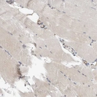 Immunohistochemical staining of human skeletal muscle shows no positivity in myocytes as expected.