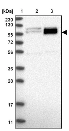 Lane 1: Marker [kDa] 230, 130, 95, 72, 56, 36, 28, 17, 11_br/_Lane 2: Human cell line RT-4_br/_Lane 3: Human cell line U-251MG sp