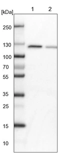 Lane 1: NIH-3T3 cell lysate (Mouse embryonic fibroblast cells)_br/_Lane 2: NBT-II cell lysate (Rat Wistar bladder tumour cells)