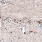 Immunohistochemical staining of human duodenum shows strong positivity in the peripheral nerve fibers in muscularis externa.