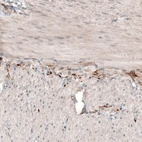 Immunohistochemical staining of human duodenum shows strong positivity in the peripheral nerve fibers in muscularis externa.