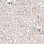Immunohistochemical staining of human liver shows very weak cytoplasmic positivity in hepatocytes.