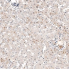Immunohistochemical staining of human liver shows very weak cytoplasmic positivity in hepatocytes.