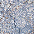 Immunohistochemical staining of human tonsil shows no positivity in non-germinal center cells as expected.