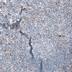 Immunohistochemical staining of human tonsil shows no positivity in non-germinal center cells as expected.