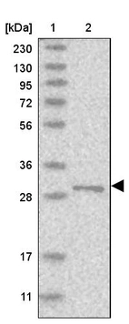 Lane 1: Marker [kDa] 230, 130, 95, 72, 56, 36, 28, 17, 11_br/_Lane 2: Human cell line RT-4
