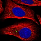 Immunofluorescent staining of human cell line U-2 OS shows localization to vesicles.