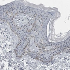 Immunohistochemical staining of human skin shows strong positivity in nucleoli in epidermal cells.
