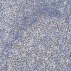 Immunohistochemical staining of human tonsil shows strong positivity in nucleoli in lymphoid cells.