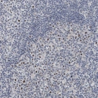 Immunohistochemical staining of human tonsil shows strong positivity in nucleoli in lymphoid cells.