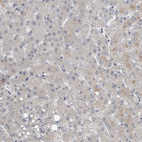 Immunohistochemical staining of human liver shows strong to strong positivity in nucleoli in hepatocytes.