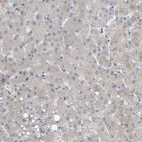Immunohistochemical staining of human liver shows strong to strong positivity in nucleoli in hepatocytes.