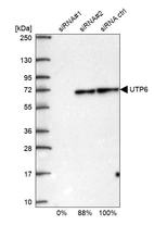 Western blot analysis in U2OS cells transfected with control siRNA, target specific siRNA probe #1 and #2, using Anti-UTP6 antibody. Remaining relative intensity is presented.