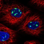 Immunofluorescent staining of human cell line A-431 shows localization to nucleoli.