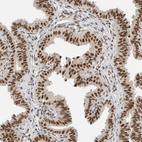 Immunohistochemical staining of human Fallopian tube shows strong nuclear positivity in glandular cells.
