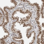 Immunohistochemical staining of human Fallopian tube shows strong nuclear positivity in glandular cells.