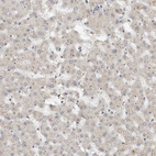 Immunohistochemical staining of human Liver shows very weak positivity in hepatocytes.