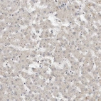 Immunohistochemical staining of human Liver shows very weak positivity in hepatocytes.
