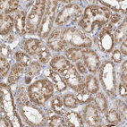 Anti-FH Antibody