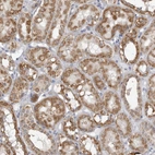 Immunohistochemical staining of human kidney shows strong cytoplasmic positivity in cells in tubules.
