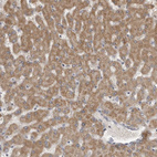 Anti-FH Antibody