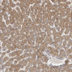 Immunohistochemical staining of human liver shows strong cytoplasmic positivity in hepatocytes.
