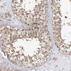 Immunohistochemical staining of human testis shows strong cytoplasmic positivity in cells in seminiferous ducts.