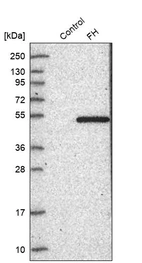 Western blot analysis in control (vector only transfected HEK293T lysate) and FH over-expression lysate (Co-expressed with a C-terminal myc-DDK tag (~3.1 kDa) in mammalian HEK293T cells, LY400053).