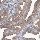 Anti-MRPL37 Antibody