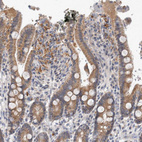 Immunohistochemical staining of human duodenum shows moderate cytoplasmic positivity in glandular cells.