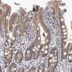 Immunohistochemical staining of human duodenum shows moderate cytoplasmic positivity in glandular cells.
